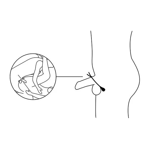 NexusForgeVibratingAdjustableLassoSiliconeCockRingBlack